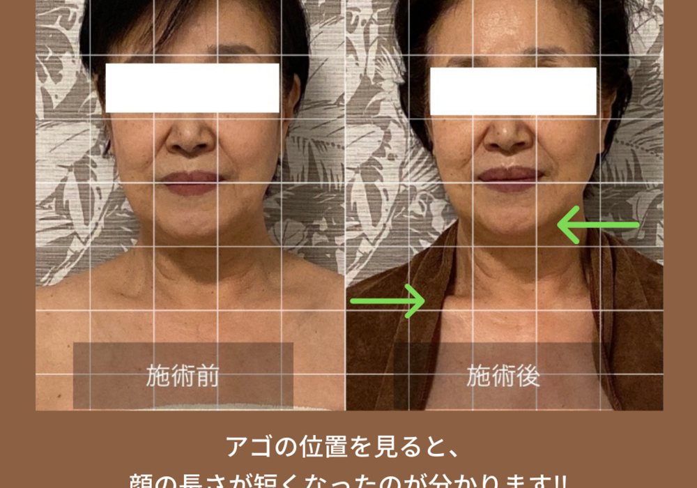 CE7659F5-2924-4758-925F-8A9F883ADD24